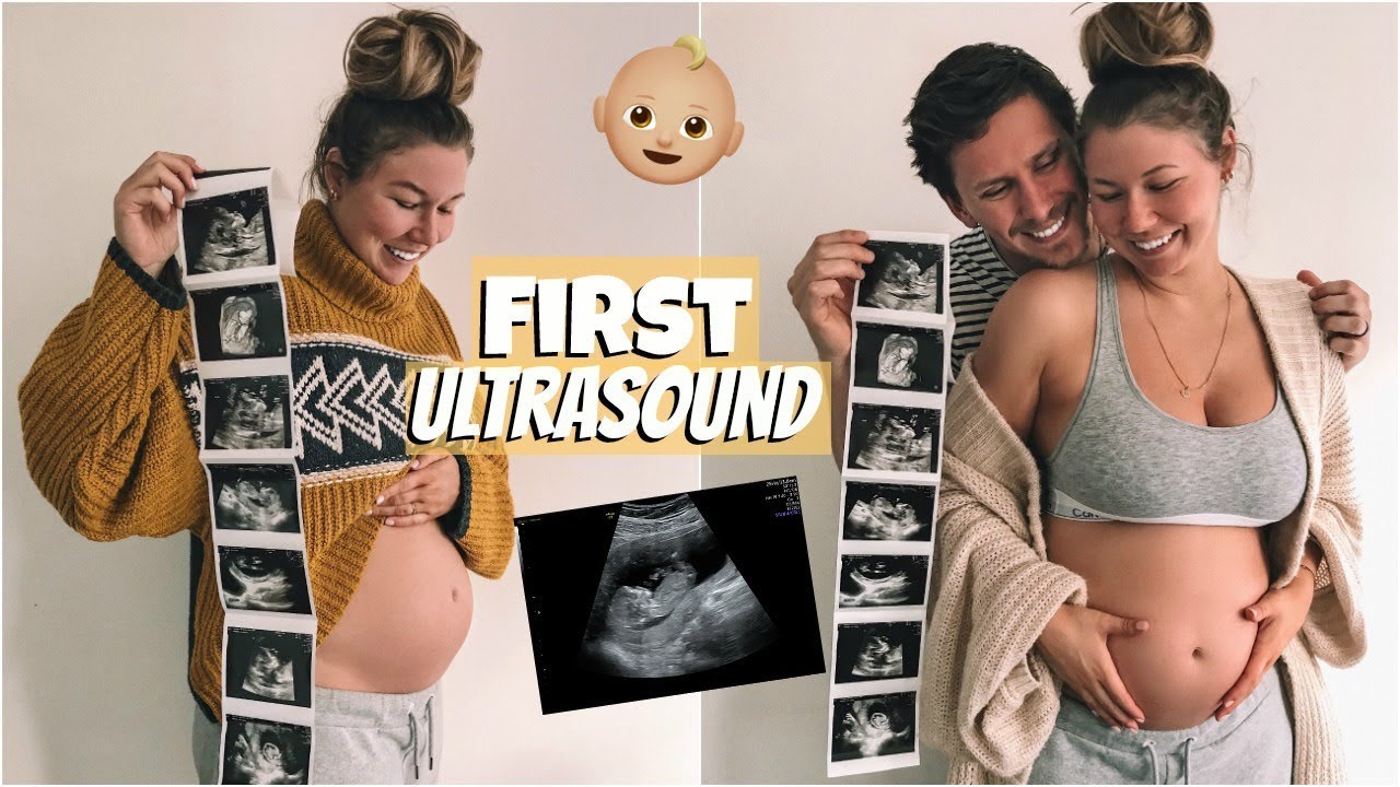 First Pregnancy Ultrasound + Hearing Baby's Heartbeat!