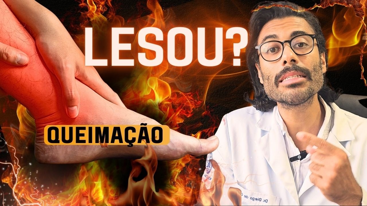 Queima&ccedil;&atilde;o e Dor nas pernas = Les&atilde;o dos Nervos? | Dr Diego de Castro Neurologista