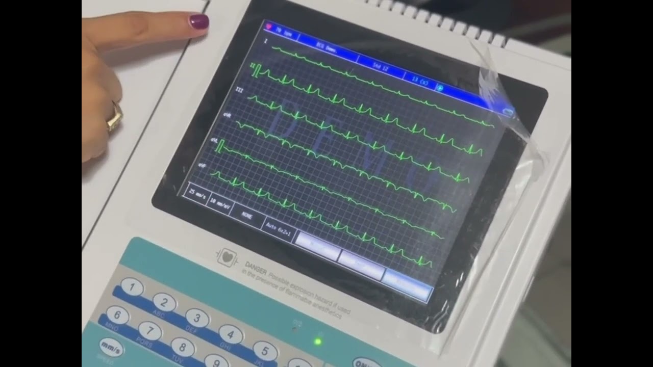 Ekg electrocardiógrafo 12 canales Contec Ecg1200G.   Presentación del equipo y modo de uso