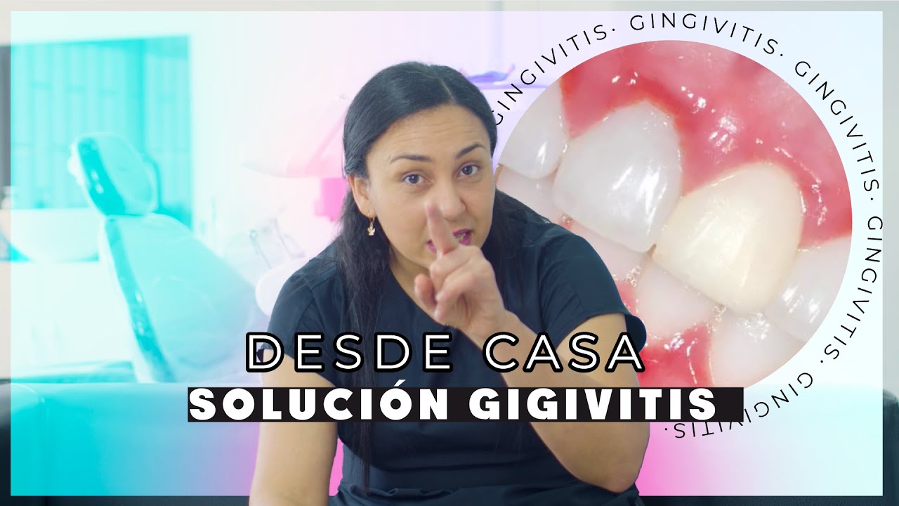Gingivitis: Tratamiento casero. | Causas y soluciones.
