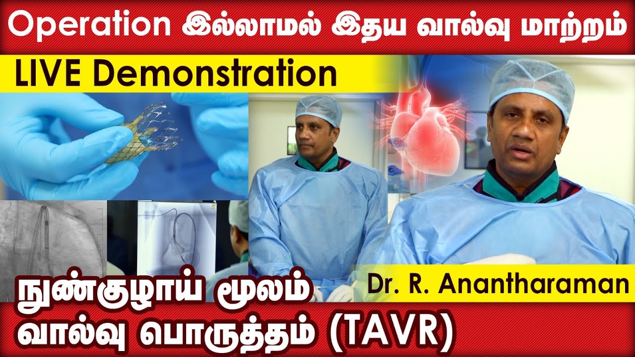 Operation இல்லாமல் இதய வால்வு மாற்றம்நுண்குழாய் மூலம் வால்வு பொருத்தம் (TAVR)  | Dr. R. Anantharaman
