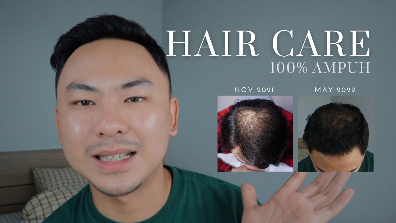 CARA MENUMBUHKAN RAMBUT DAN CARA MENGATASI KEBOTAKAN VERSI GUE // REE DERMA, BONVIE, LOREAL.