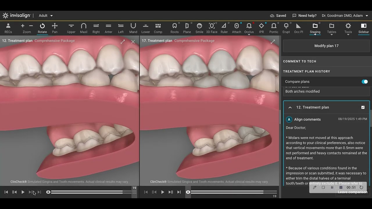 Why Change a Comfortable Occlusion During Adult Invisalign Treatment?