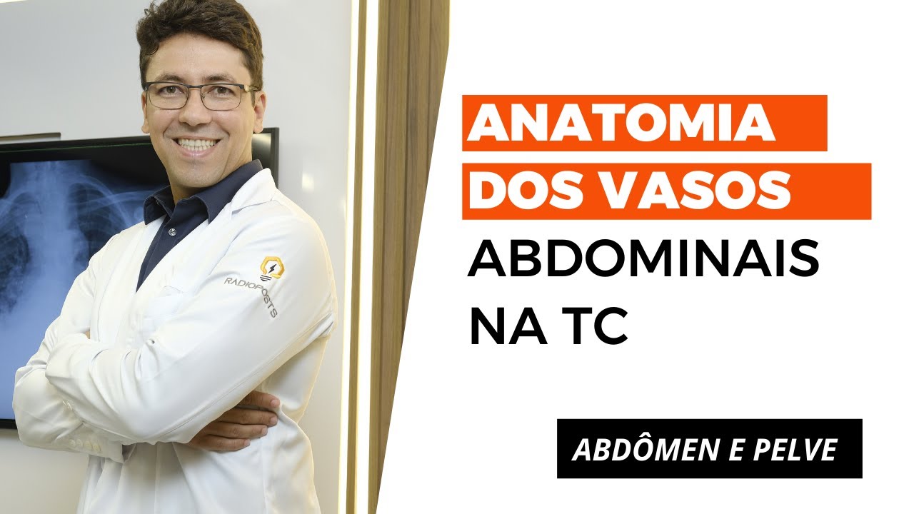 ANATOMIA DOS VASOS ABDOMINAIS NA TC