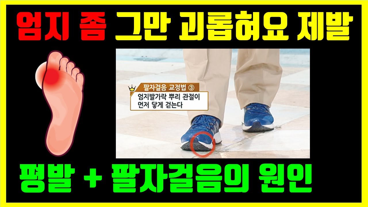 당신을 엄지발가락 혹사 혐의로 고발합니다. 평발 팔자걸음 만드는 엄지로 밀어주는 걷기 그만! ft.무지외반증