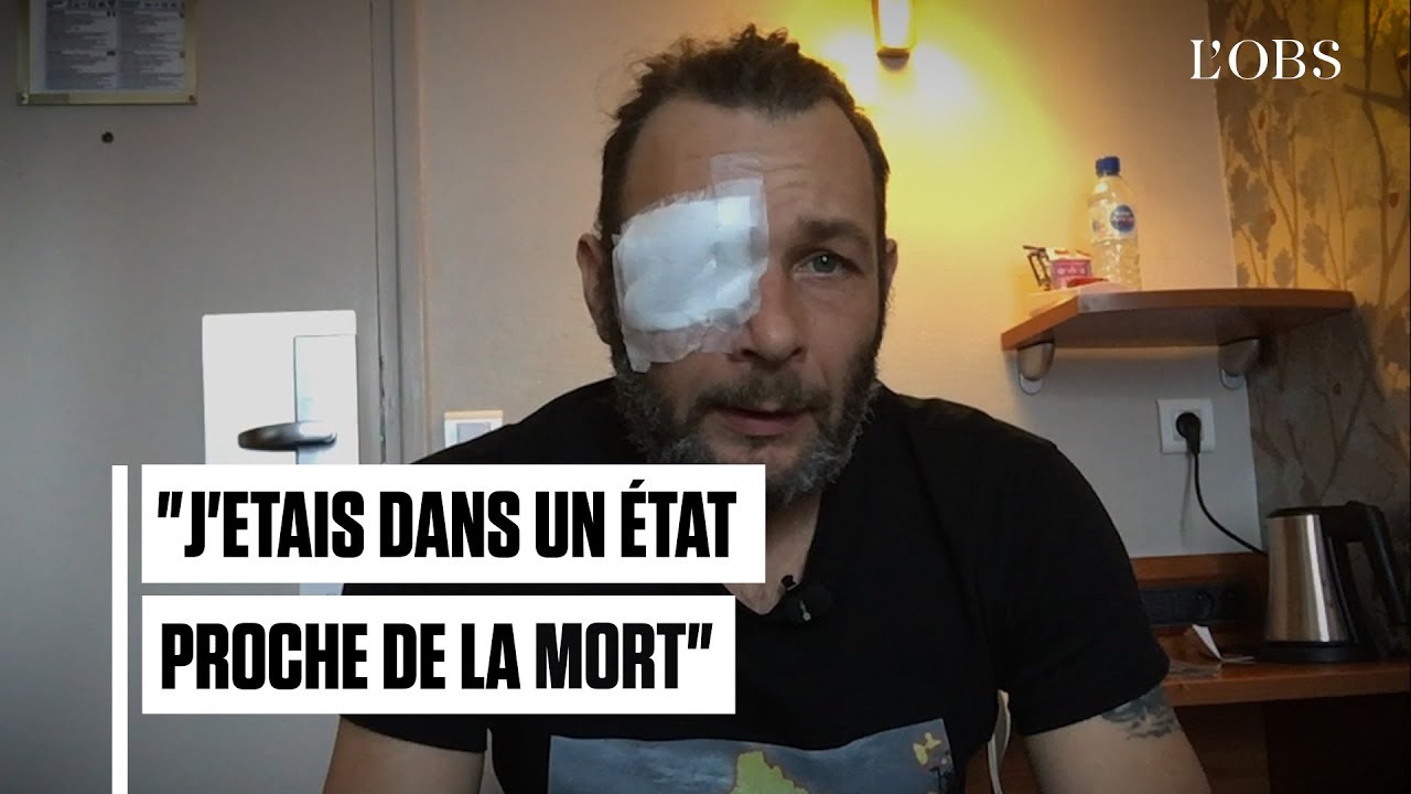 Jim, horticulteur, a perdu son œil après un tir de LBD lors de l'acte 8 des 
