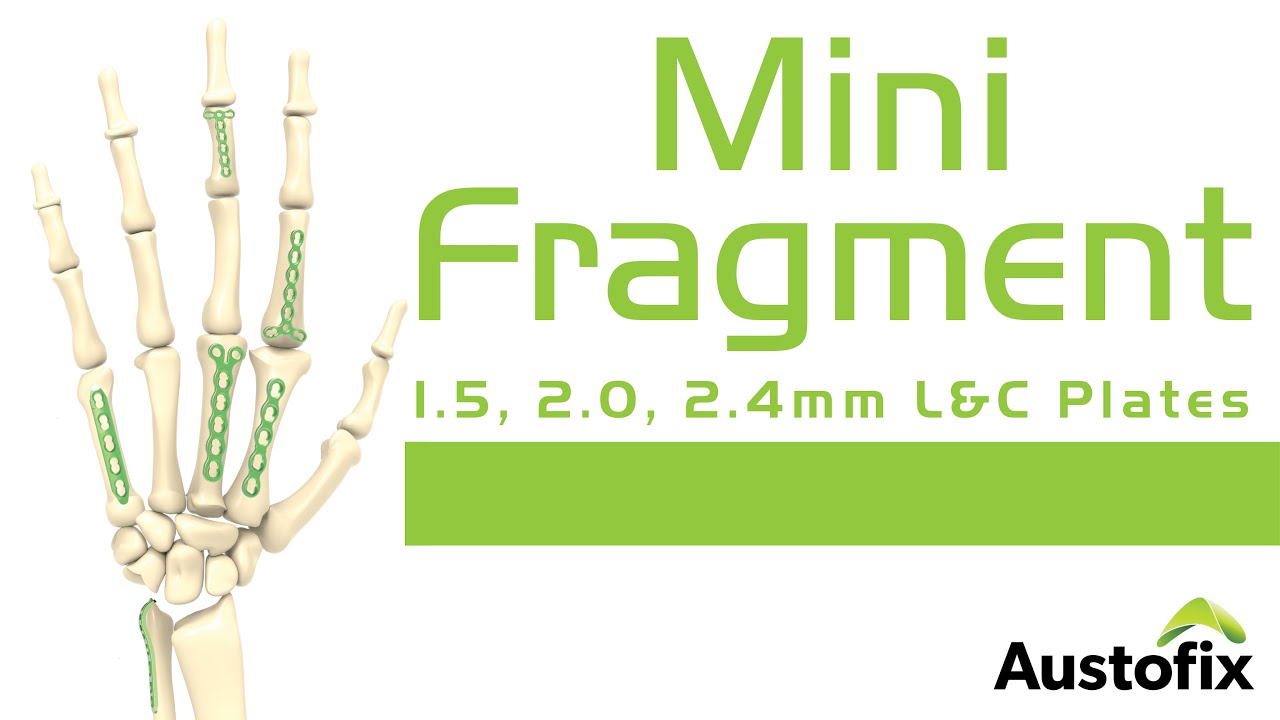 Austofix Mini Fragment Plate System Animation