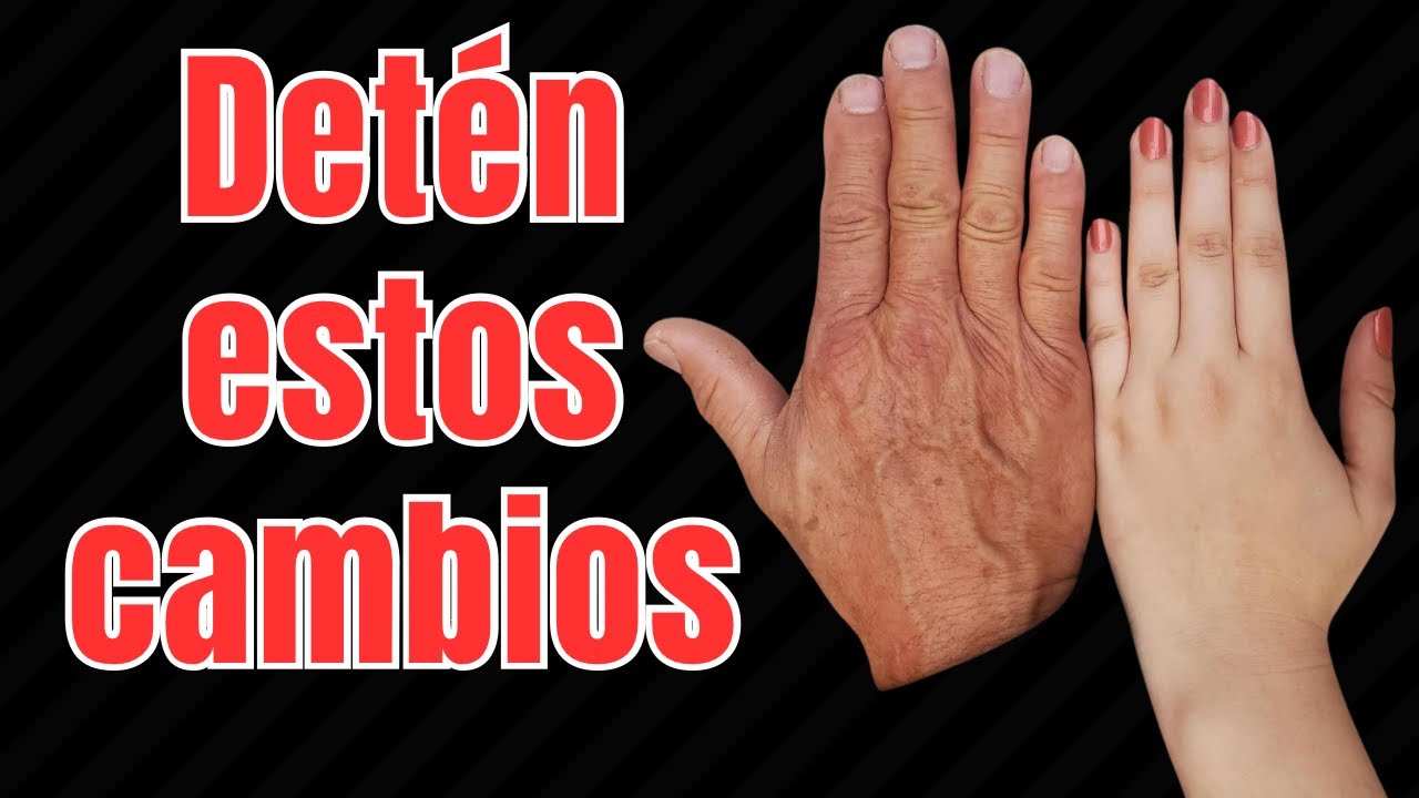 Así ENVEJECEN LAS MANOS y esto te ayudara a evitar