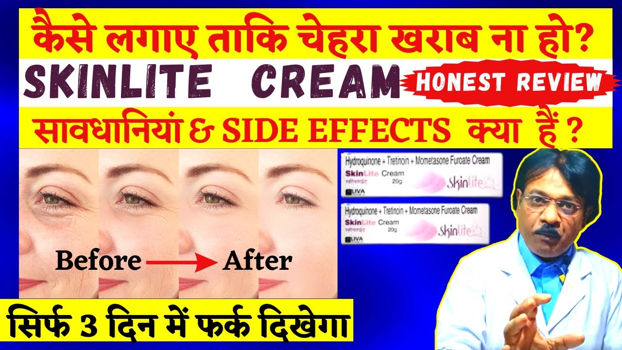 SkinLite Cream Review 2023, Uses, Precaution in Hindi | Skin whitening cream | लगाने का सही तरीका