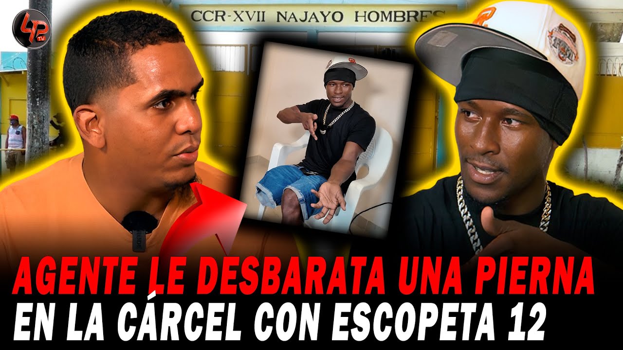 PERDIÓ UNA PIERNA LUEGO QUE UN AGENTE DE LA CÁRCEL LE DISPARÓ CON UNA ESCOPETA A QUEMARROPA EN MOTÍN