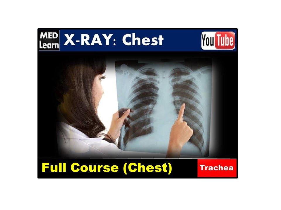 X RAY Chest (2) (Trachea)    #cme #internal_medicine #medicalstudent #usmle #محاضرات_باطنة