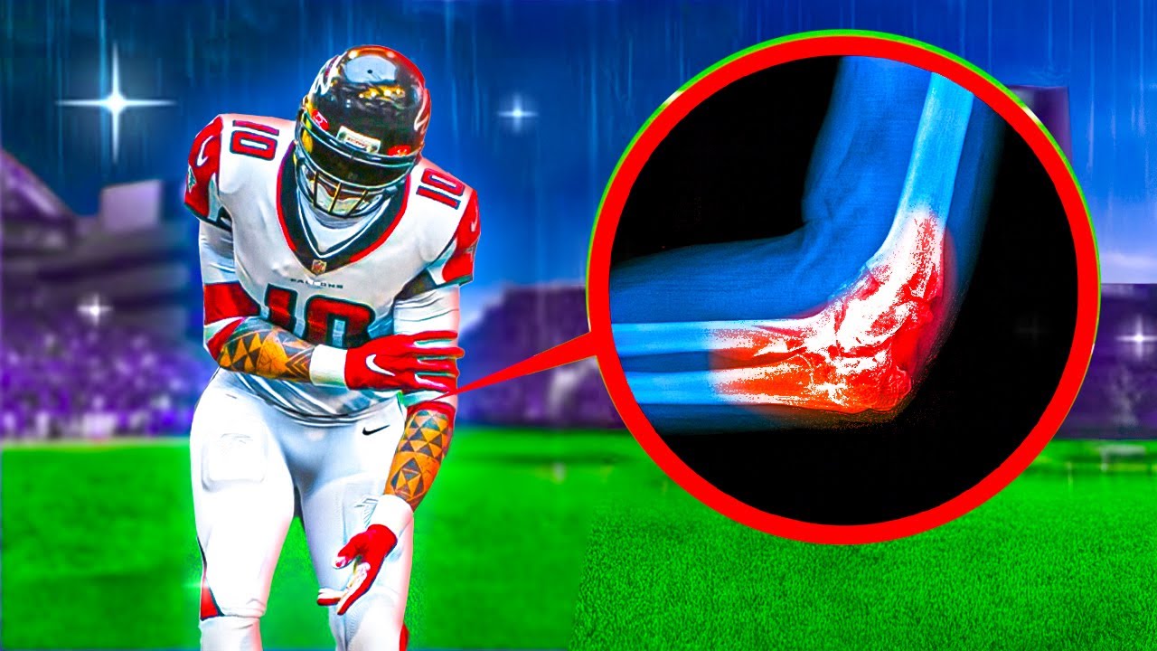I Got Injured Bad.. Madden 26 Superstar Mode #10