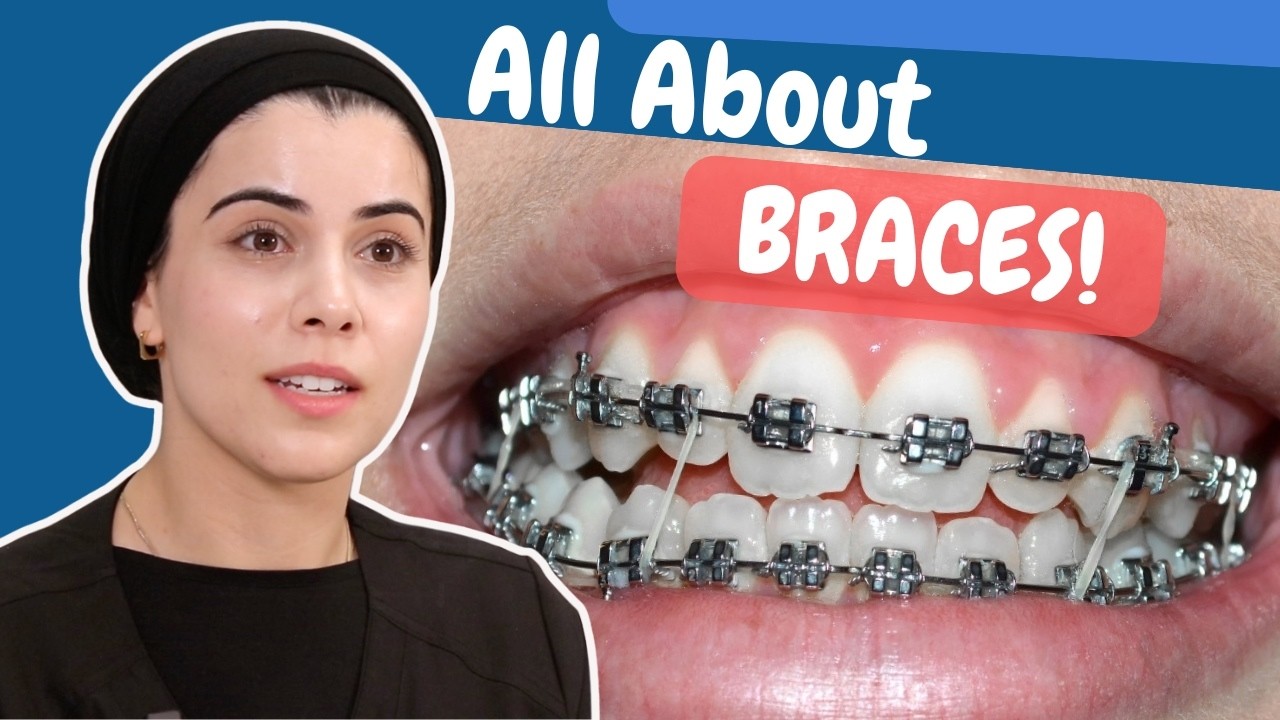 How braces work?