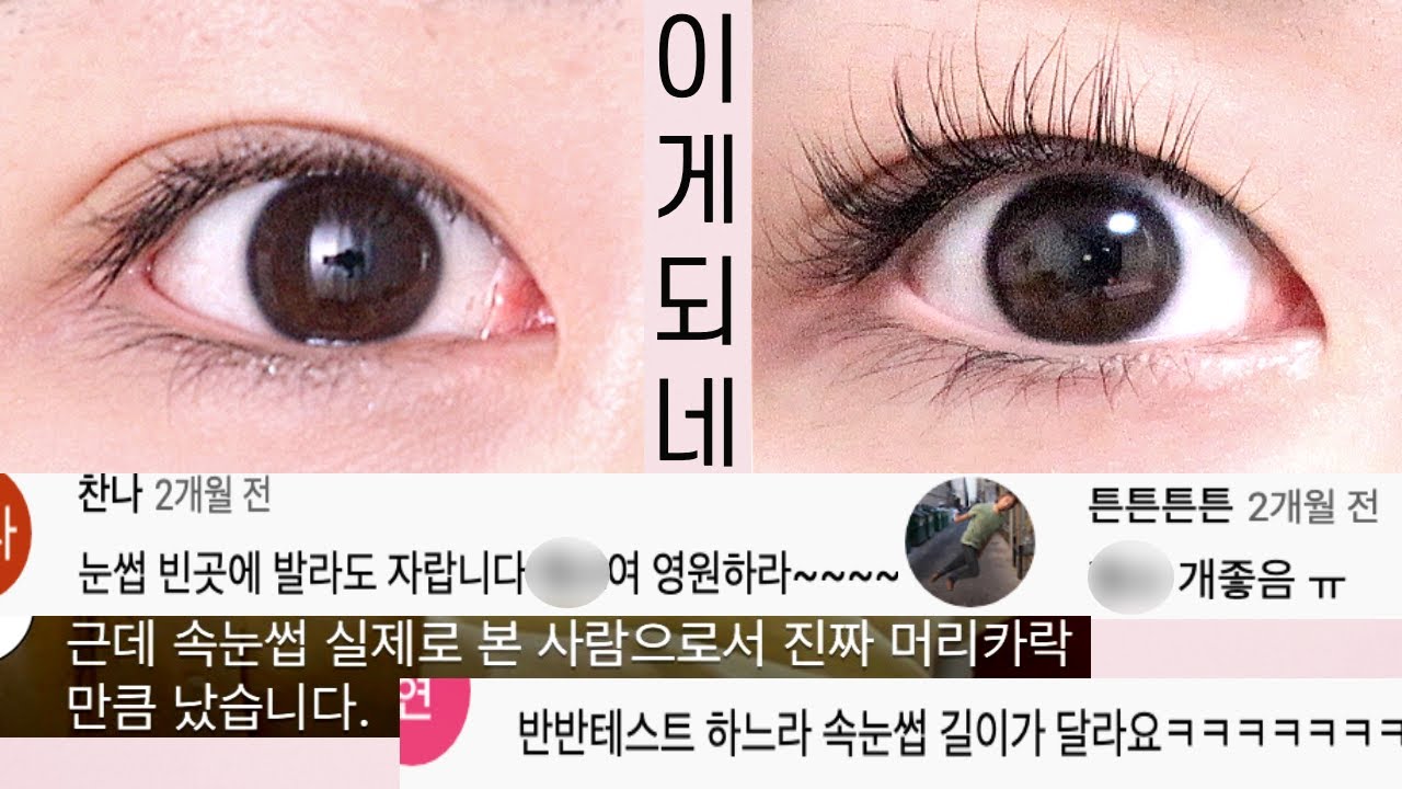 내돈내산 대란 속눈썹영양제 한쪽만 바르기 챌린지 (헤어라인 후기/ 부작용/ 다크서클/ 속눈썹영양제 바르는법) [마롱실험실]