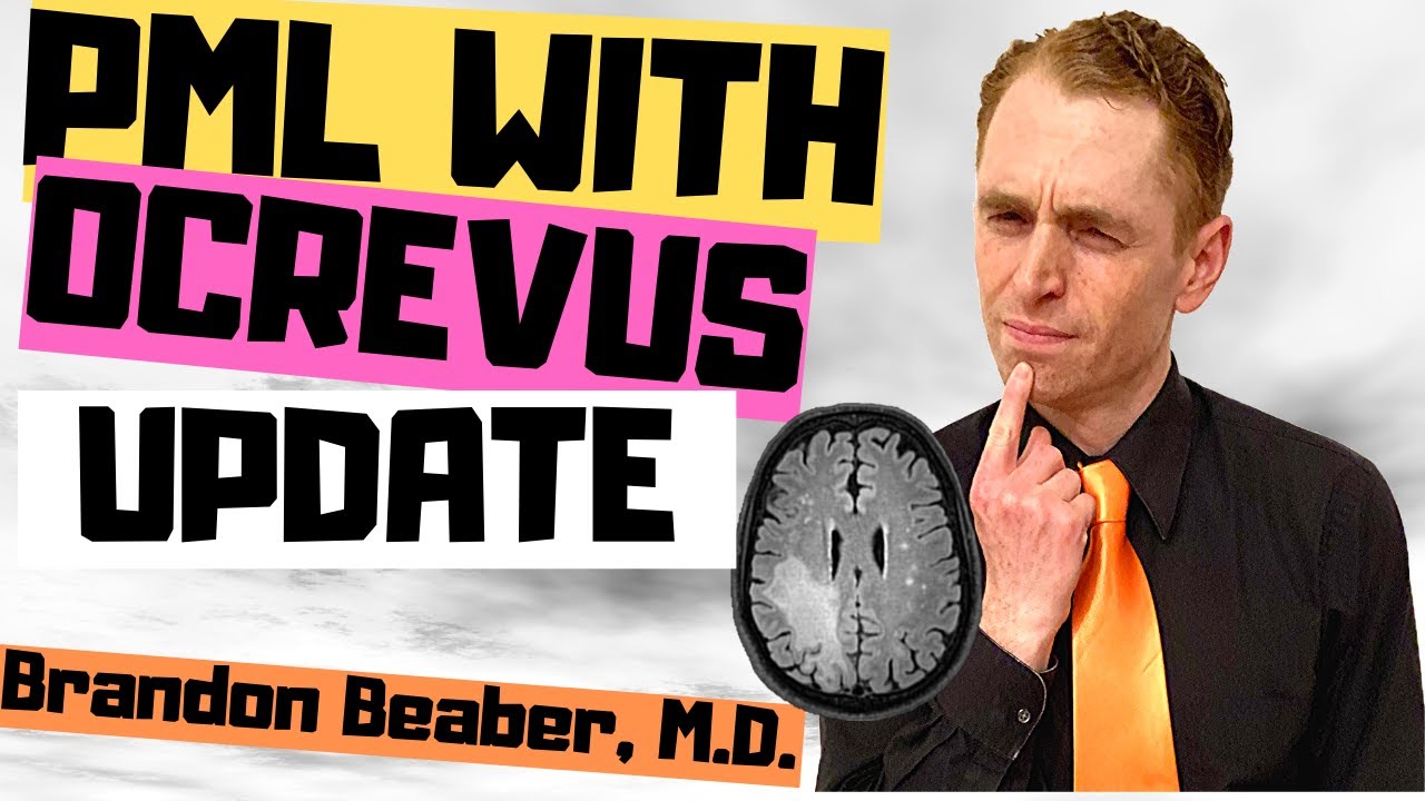 Ocrevus PML Case Update