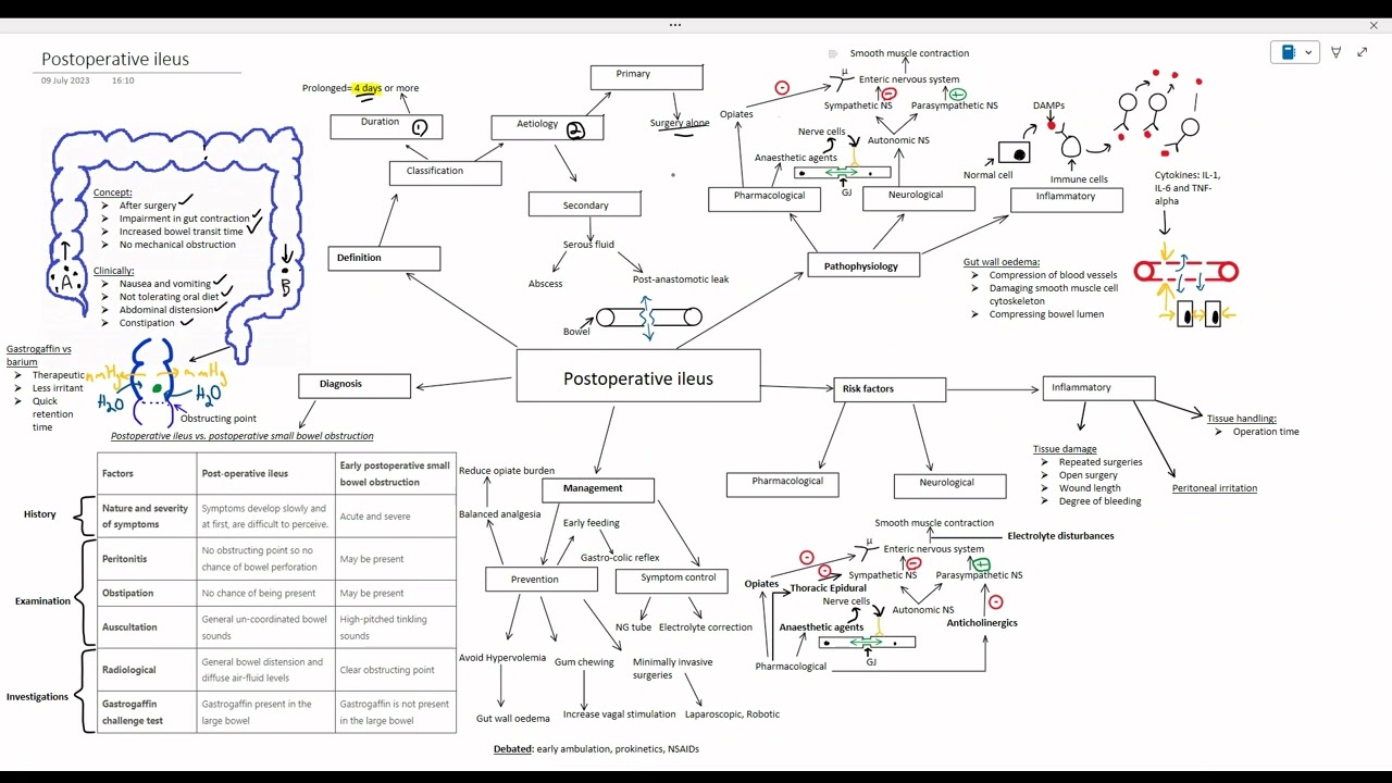 Post-Operative Ileus Demystified (Part 1) - Understanding Definition, Aetiology, and Pathophysiology