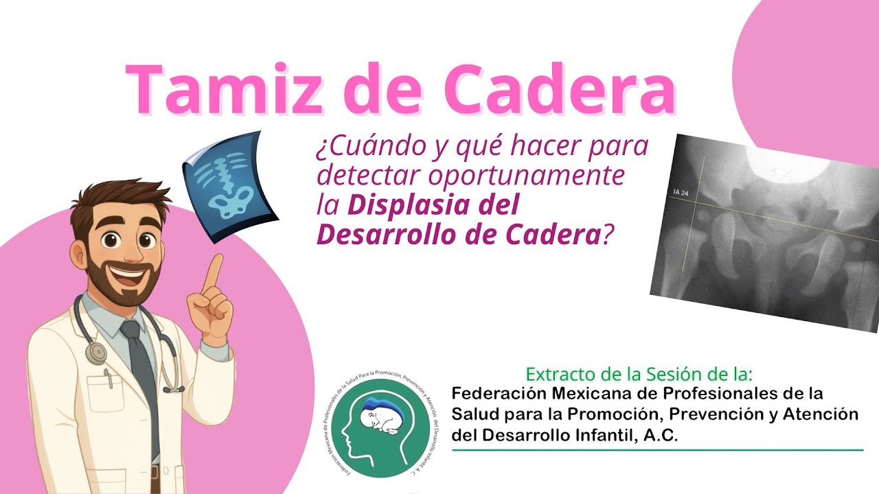 Tamiz de Cadera ¿Cuándo y qué hacer para detectar la displasia de desarrollo de cadera?