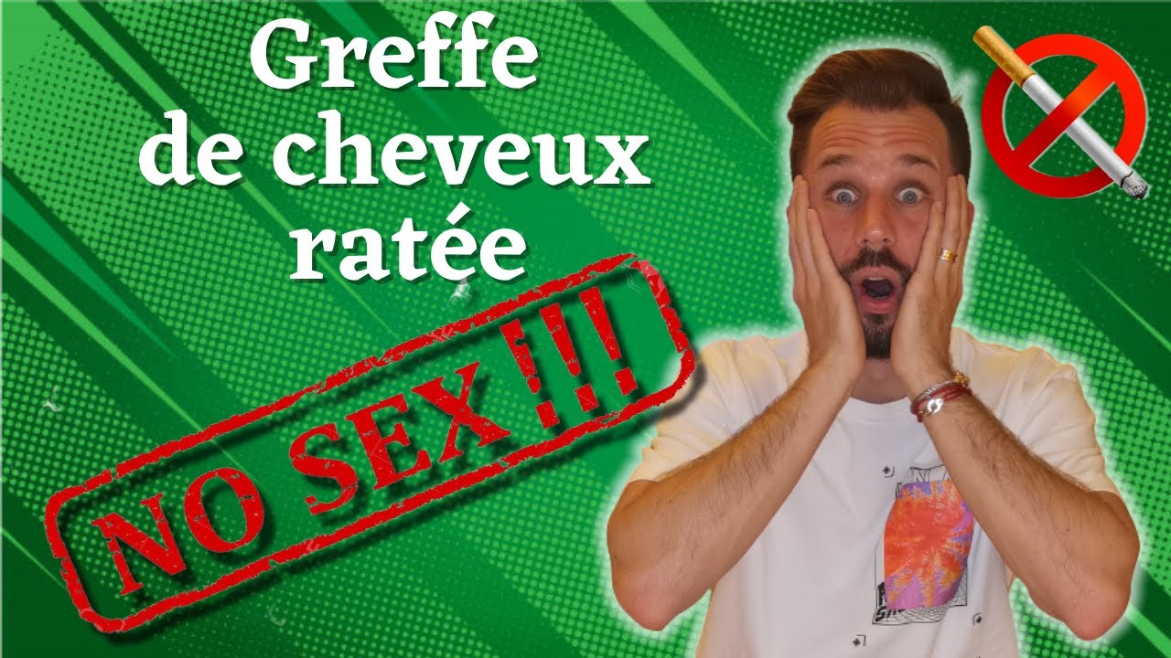 GREFFE DE CHEVEUX TURQUIE. Comment ne pas rater sa greffe.