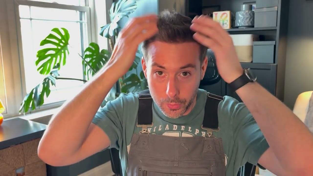 9 Month Update | Hair Transplant in Turkey at the Cosmedica Clinic with Dr. Acar