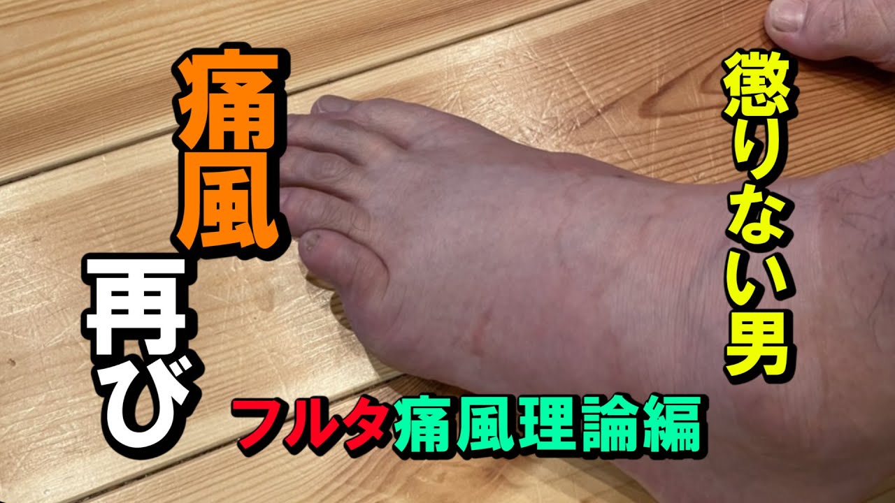 [痛風] 　懲りない男、再び痛風　フルタ痛風理論編