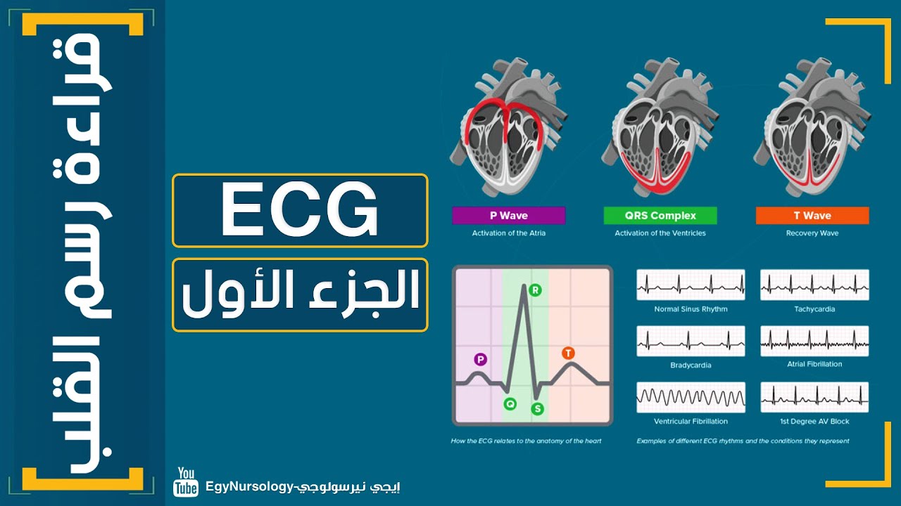 شرح قراءة رسم القلب | (ECG) الجزء الأول  - EgyNursology