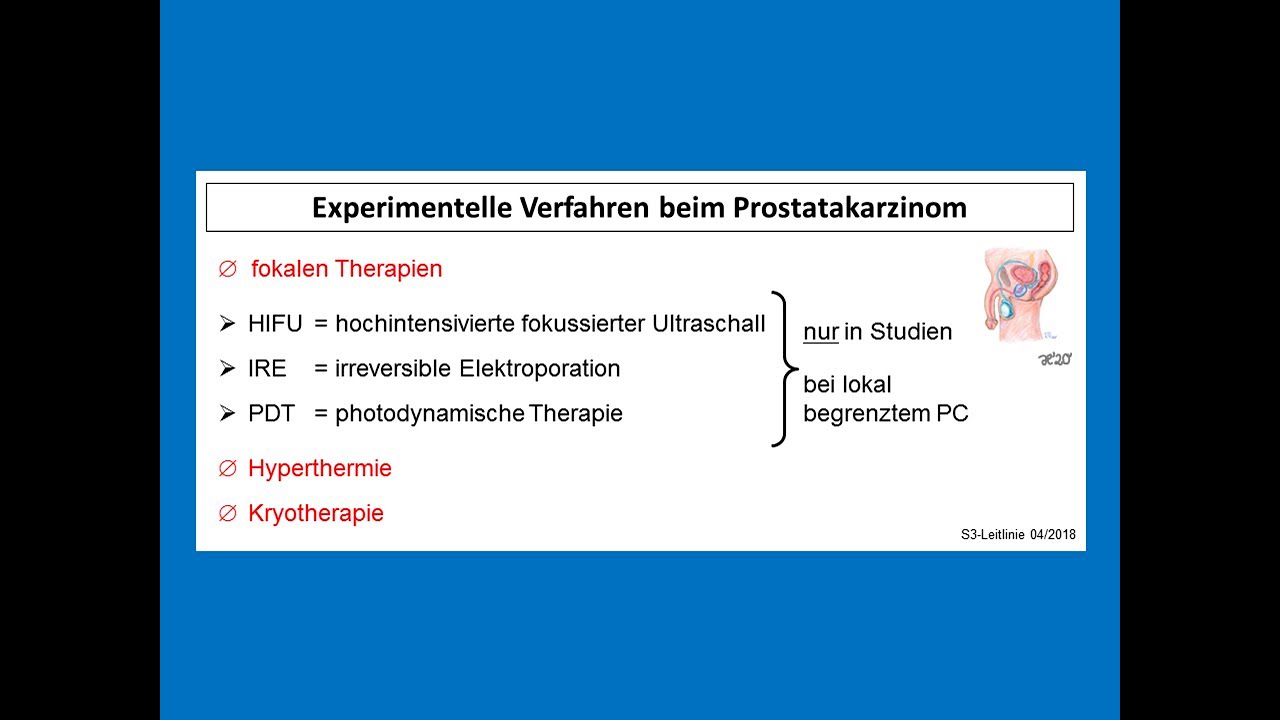 Experimentelle Therapien beim Prostatakarzinom | Strahlentherapie Prof. Hilke Vorwerk
