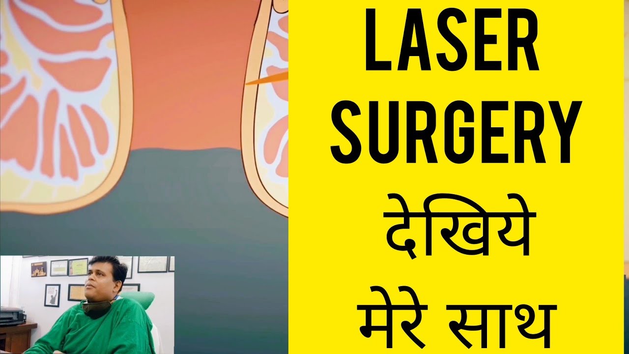 फिस्टुला में लेज़र ऑपरेशन देखिये मेरे साथ (Laser Surgery In Fistula In Ano)