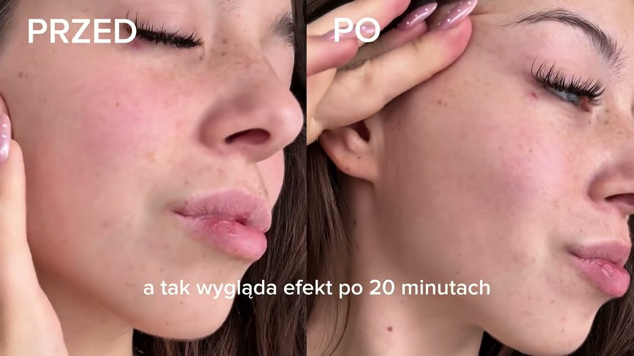 30 dni i nowa sk&oacute;ra? Test masek kolagenowych Dr.HEDISON 💧