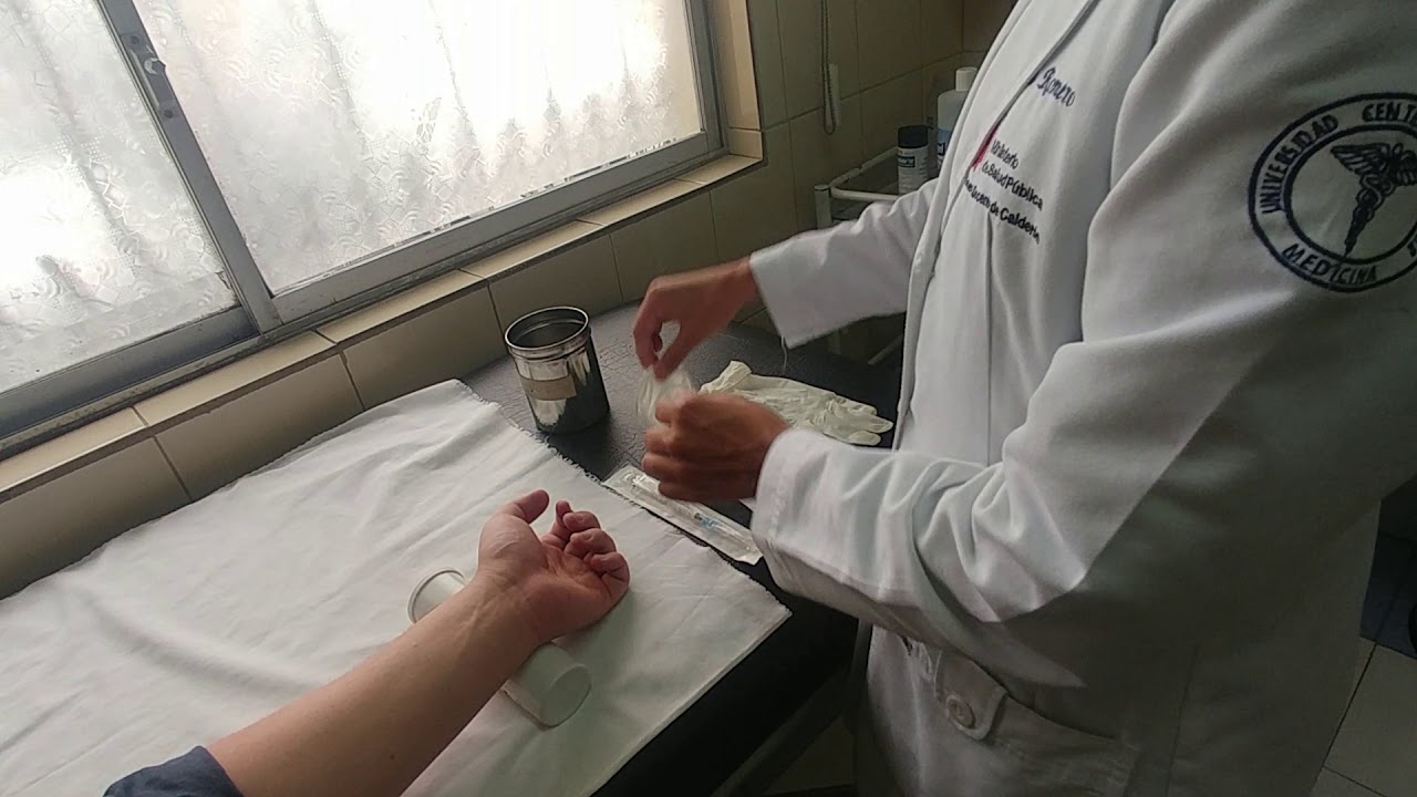 Toma de gasometría arterial