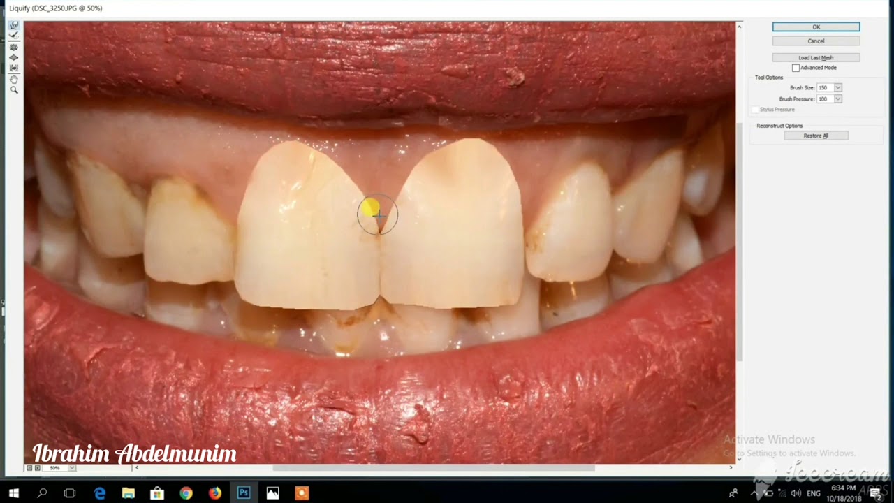 Photoshop Smile Design .