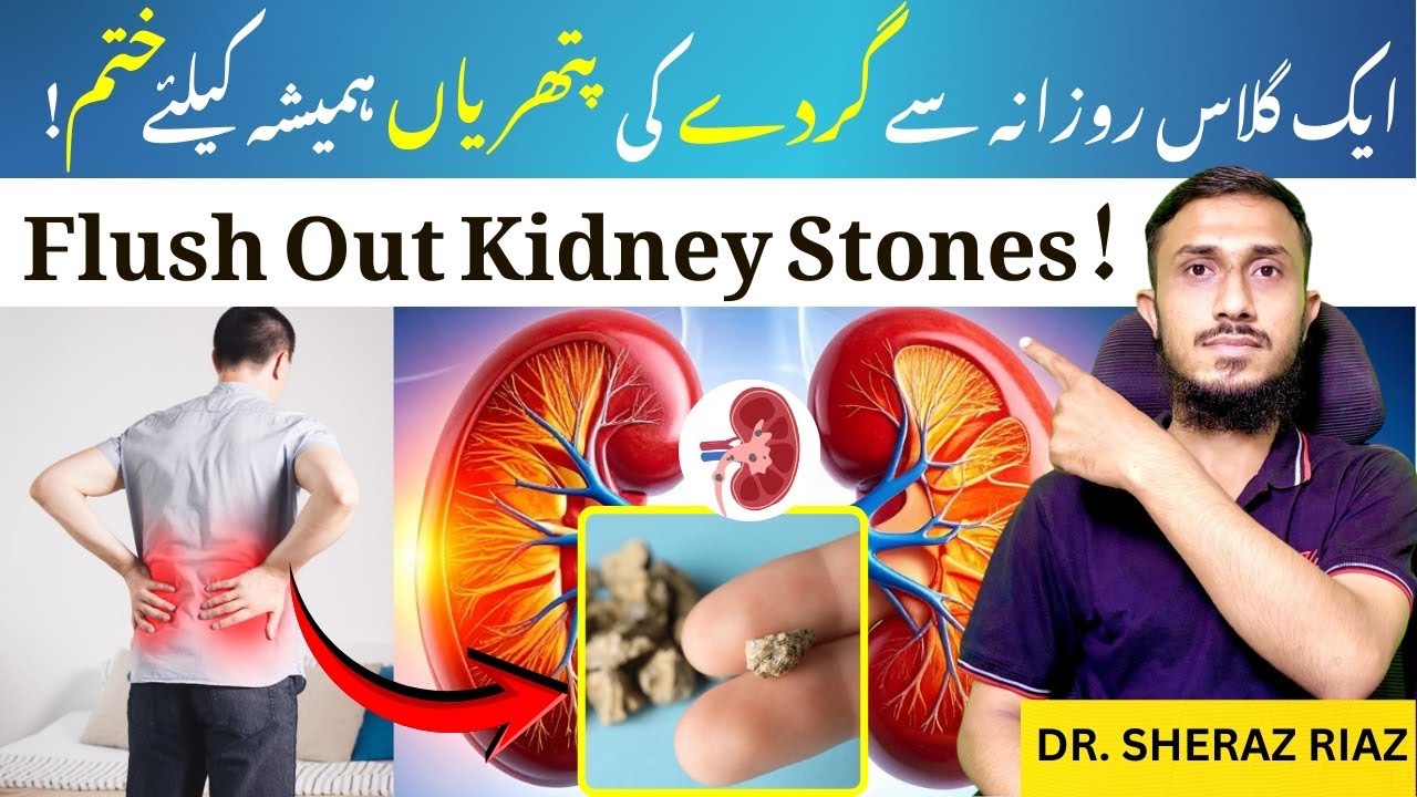 MAGIC DRINK : Best Way to Prevent Kidney Stones | Kidney Stones ka ilaj | Dr.Sheraz Riaz