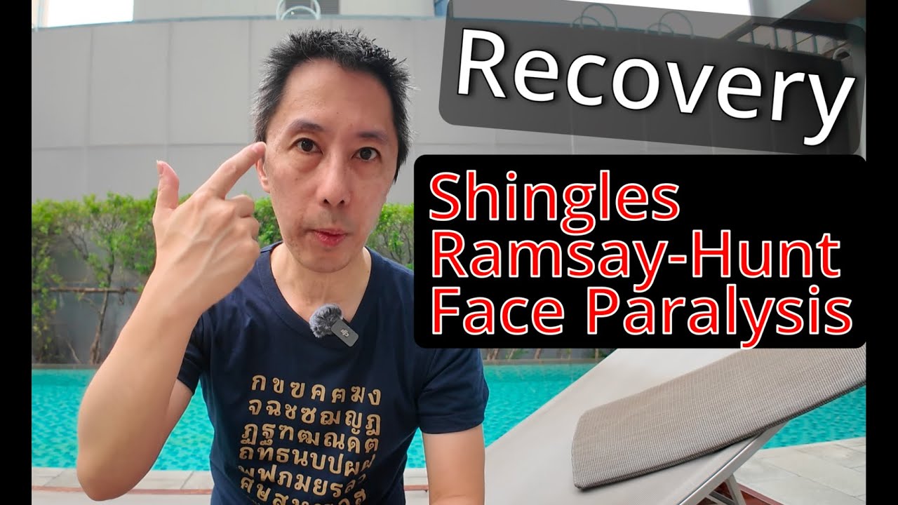 Recovering from Shingles, Ramsay-Hunt and Facial Paralysis - 3 Months