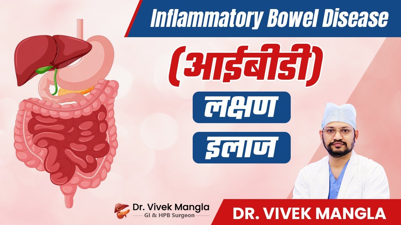Inflammatory Bowel Disease क्या है? | IBD के लक्षण&nbsp;और&nbsp;इलाज | पाचन तंत्र की सूजन | Dr. Vivek Mangla