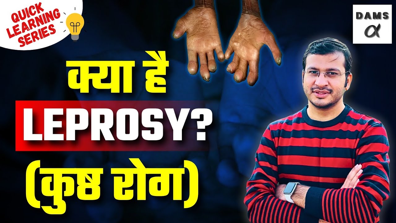 What is Leprosy? Complete Details | Quick Learning Series By Siddharth Sir | DAMS Nursing