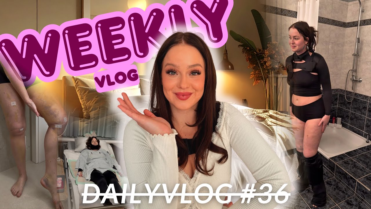 WEEKLY VLOG | Ehrliches Update nach meiner Liposuktions-OP 🏥✨
