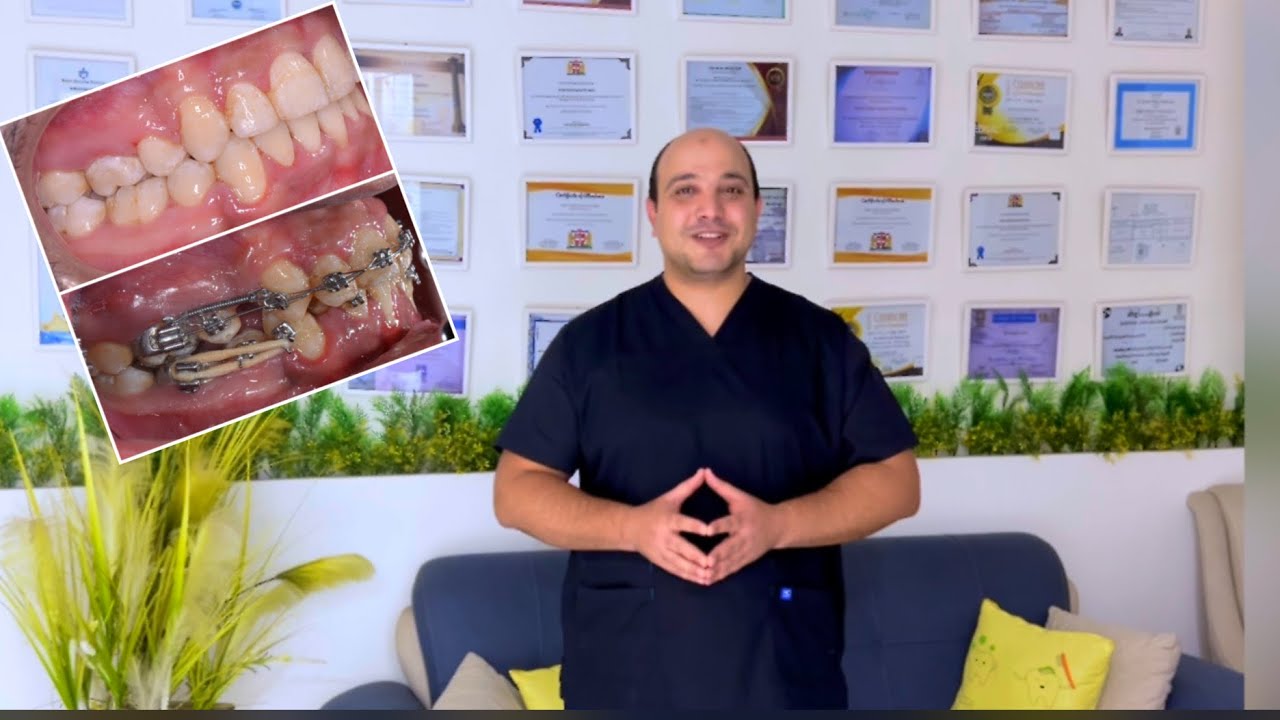 هل ممكن أغير دكتور التقويم ؟   تقويم الأسنان مع دكتور اسلام نبيل