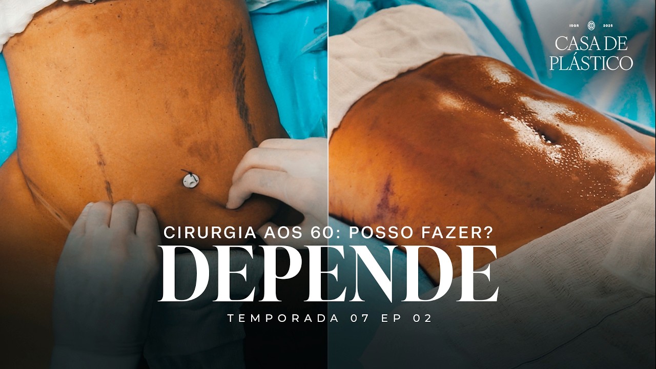 ELA JÁ FEZ CIRURGIA ANTES… e decidiu operar novamente aos 60 | Casa de Plástico