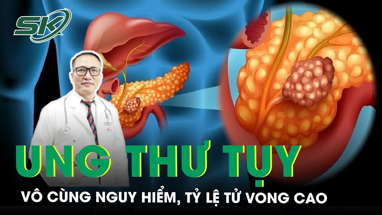 Ung Thư Tuỵ, Căn Bệnh Vô Cùng Nguy Hiểm, Tỷ Lệ Tử Vong Cao Thường Phát Hiện Ở Giai Đoạn Muộn | SKĐS