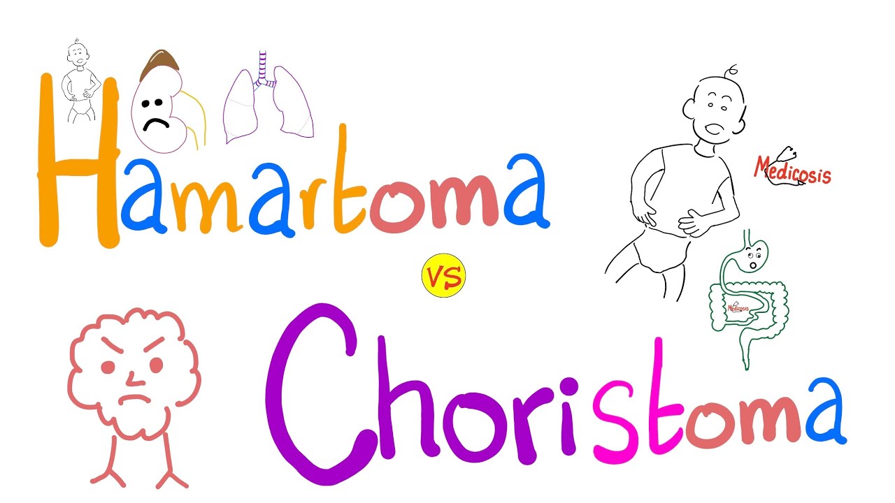 Hamartoma vs. Choristoma - Is this cancer?  |  Pathology Series