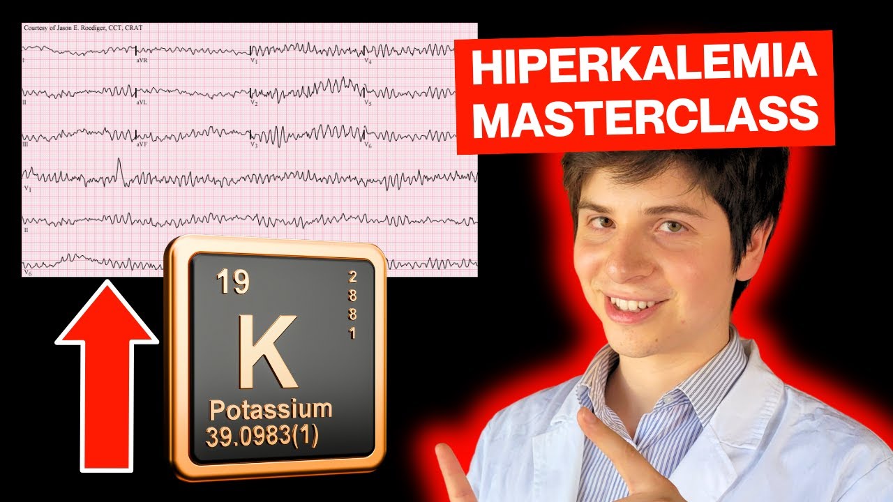 HIPERKALEMIA TRATAMIENTO: MASTERCLASS en 10 minutos o menos