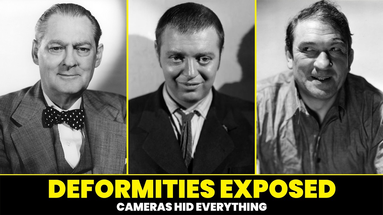 Golden Age Hollywood Stars with secret disabilities and deformities