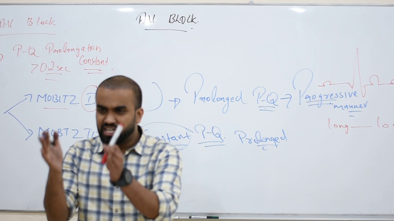 AV BLOCK MADE SIMPLE WITH MNUEMONICS