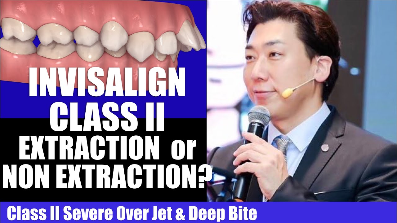 Invisalign Class II Extraction or Non Extraction?【インビザライン抜歯か非抜歯？】