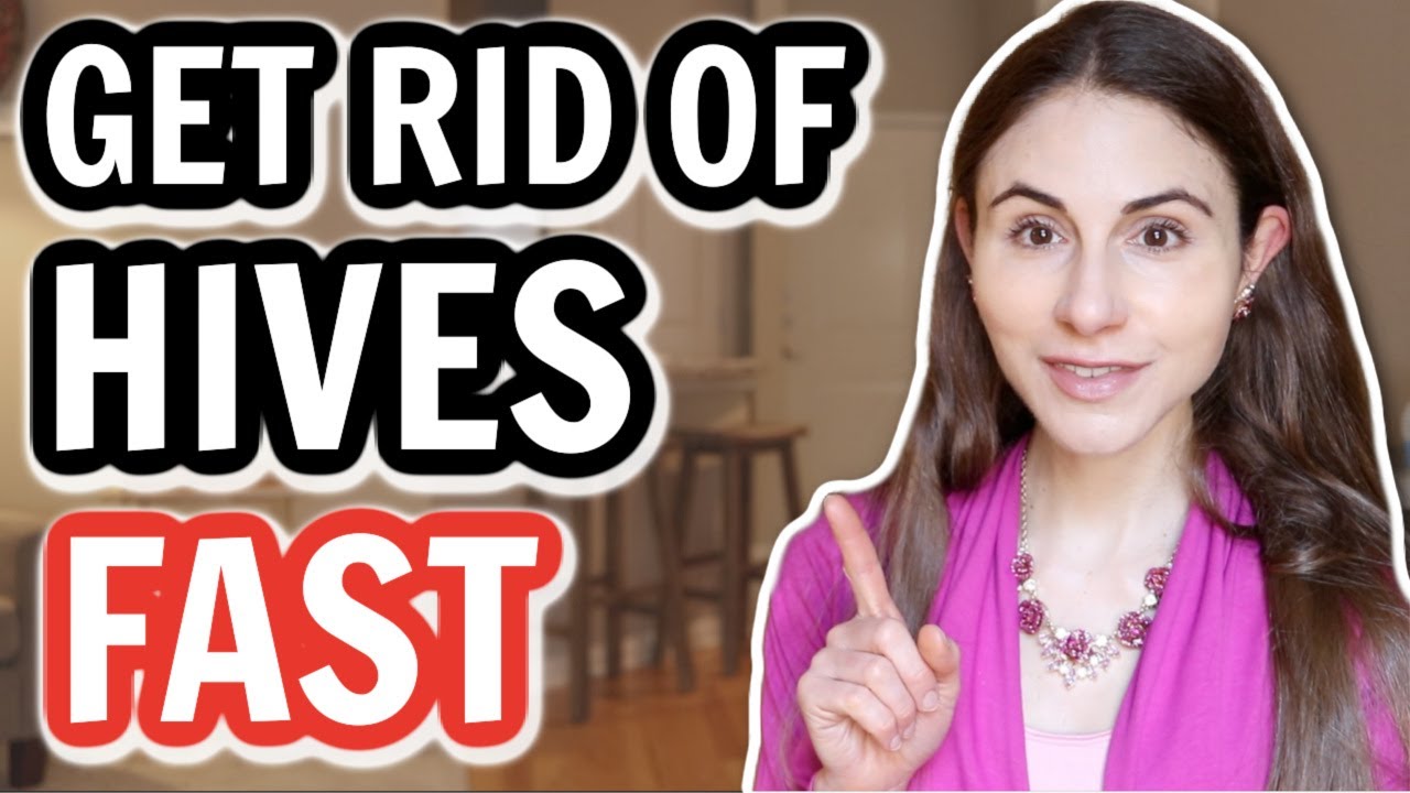 10 TIPS TO GET RID OF HIVES | Dermatologist @Dr Dray