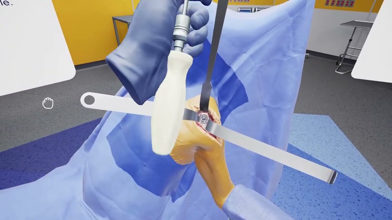 Tornier Perform Glenoid - Full wedge: App Walkthrough