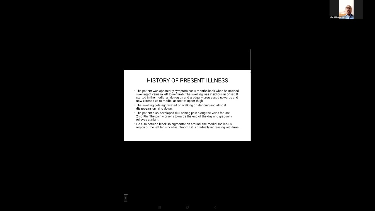 Case Presentation - Varicose Veins (11.05.2021)