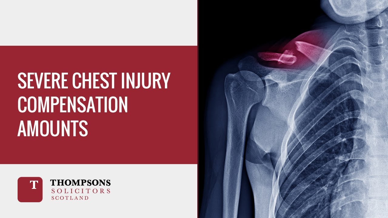 Severe Chest or Internal Organ Injury Compensation Amounts