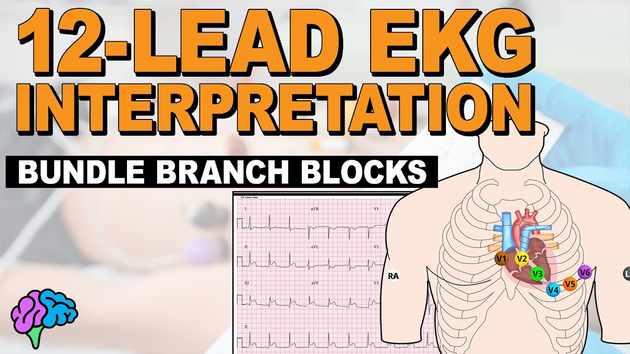 Bundle Branch Blocks MADE EASY!! - 12 Lead EKG