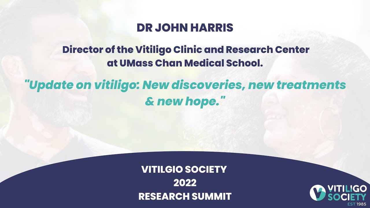 Update on vitiligo: New discoveries, new treatments & new hope