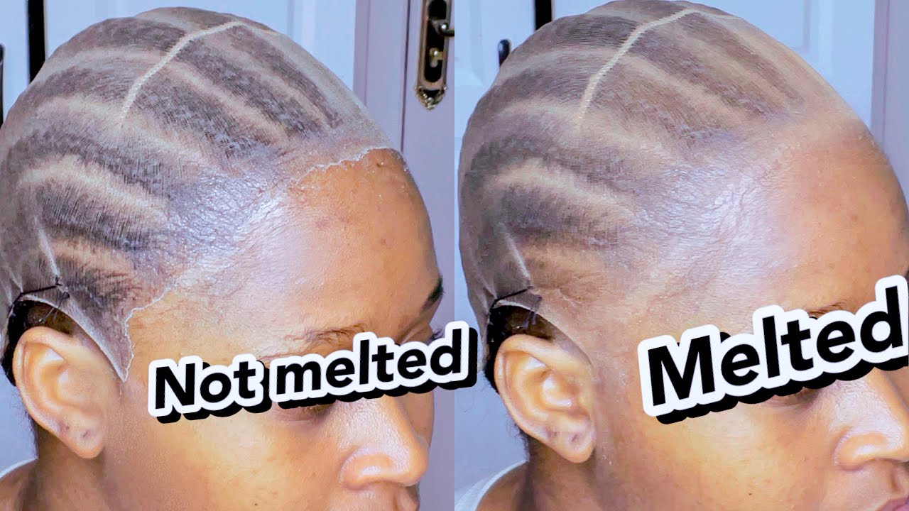 UPDATE |HOW TO DO BALD CAP METHOD VERY DETAILED BEGINNERS FRIENDLY . I learned from an online class